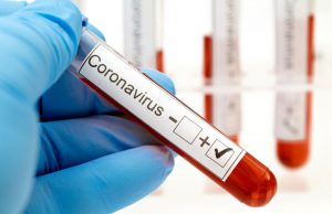 HMH testing for covid-19 to change